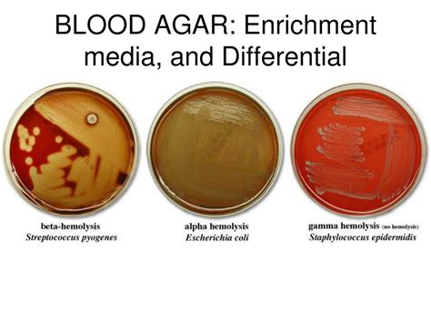 blood agar differential media